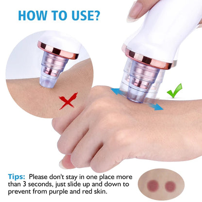Original 5-in-1 Blackhead remover 🤩 | Multi-Functional | With Rechargeable 🔋